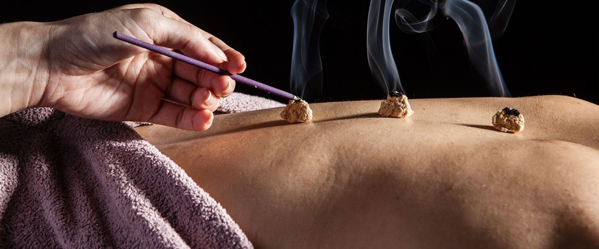 What is Moxibustion and How is it Different from Acupuncture?