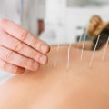Unlocking The Benefits: Integrating Thai Massage And Acupuncture In Long Beach, California