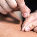 Caring for Your Skin After Acupuncture: How to Avoid Infection and Irritation