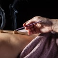 What is Moxibustion and How is it Different from Acupuncture?