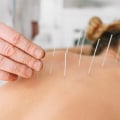 What Acupuncture Can and Cannot Treat