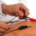 Can Acupuncture Help Reduce Inflammation in the Body?