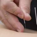 When is Acupuncture Not Safe? A Comprehensive Guide