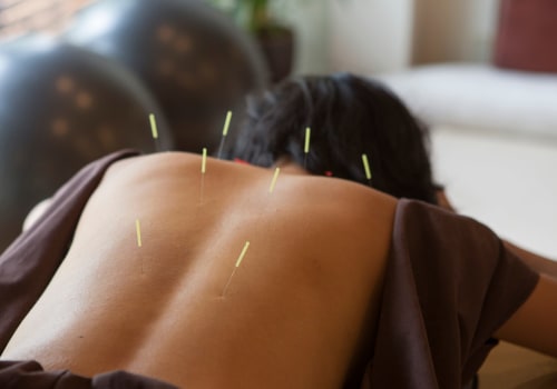 What Do You Need to Know Before Acupuncture Treatment?