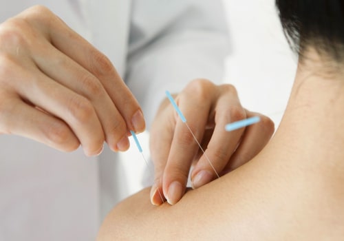 3 Illnesses Treated by Acupuncture: A Comprehensive Guide
