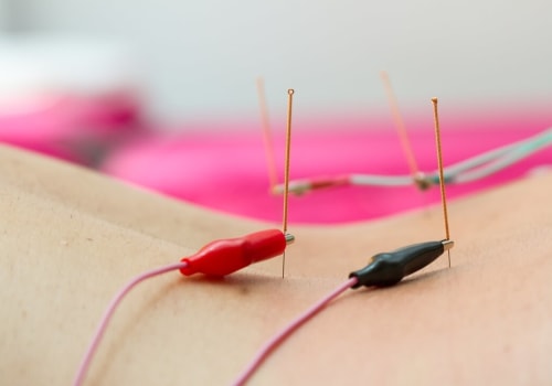 What is Electroacupuncture and How Does it Differ from Traditional Acupuncture?