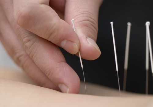 What is Acupuncture and How Does it Work?