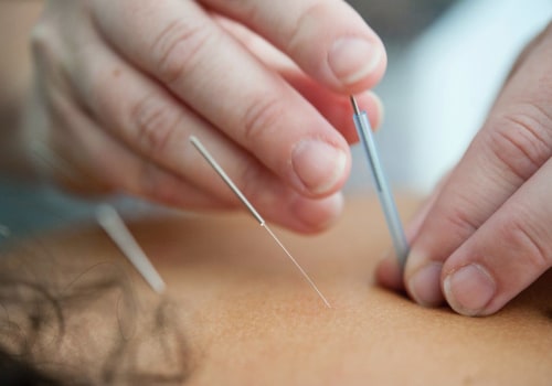 Unraveling the Mystery of Acupuncture: How Does it Work Step by Step?