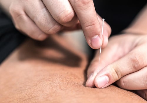 Caring for Your Skin After Acupuncture: How to Avoid Infection and Irritation