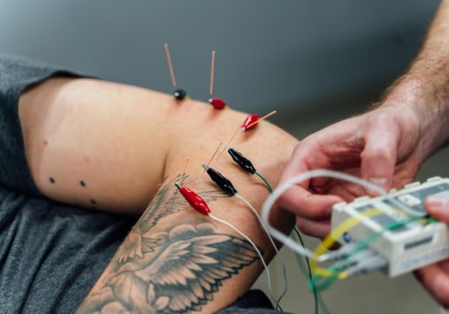Unraveling the Mystery of Acupuncture: How Does It Work?
