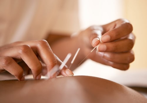 Can I Receive Acupuncture If I Have a Bleeding Disorder or Take Blood Thinners?