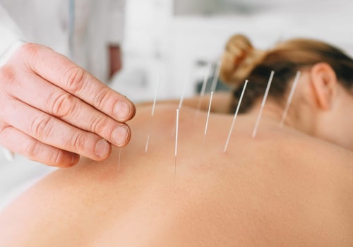 What Acupuncture Can and Cannot Treat