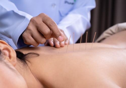 How Long Does an Acupuncture Session Last?