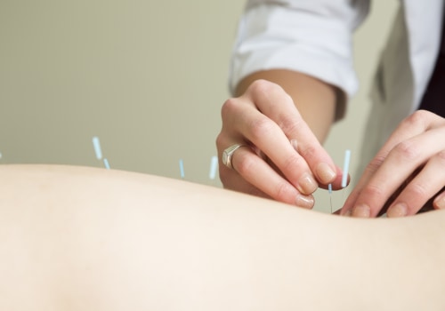 The Science Behind Acupuncture: Is There Evidence to Support Its Use for Treating Conditions?