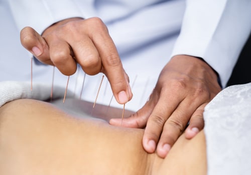 What Conditions Can Be Treated with Acupuncture?